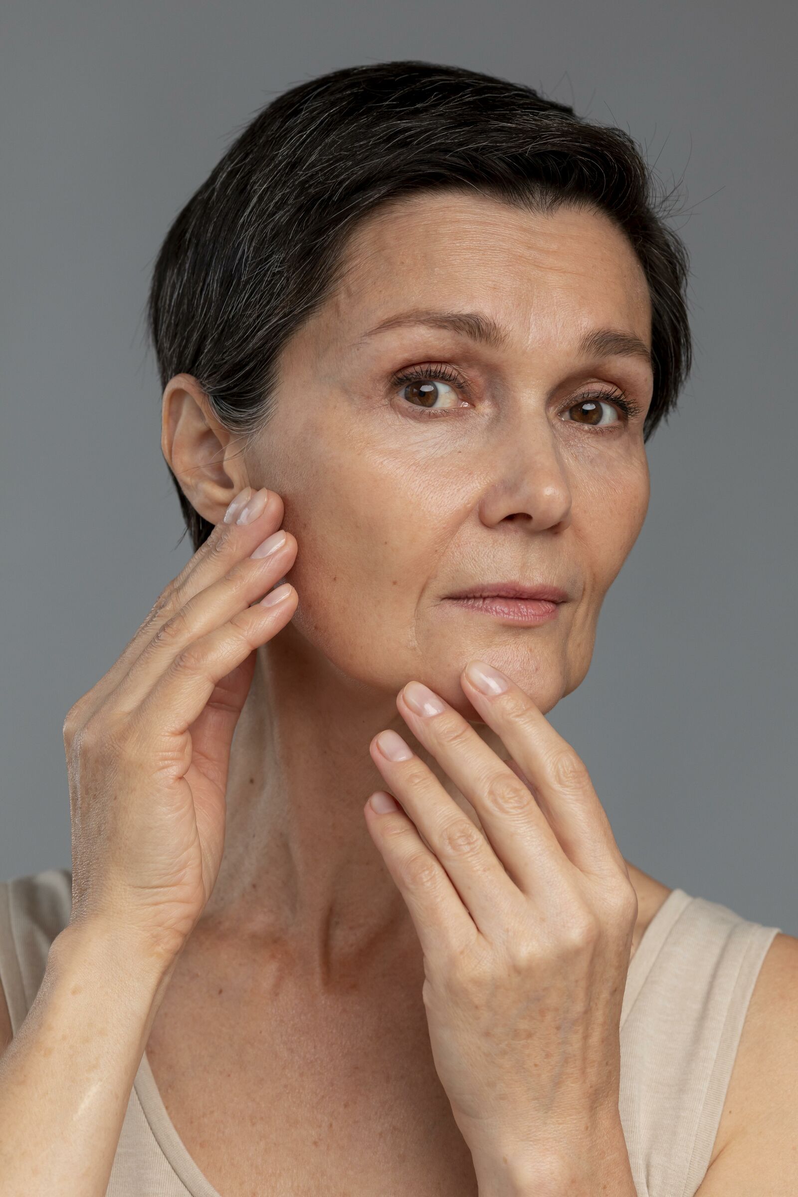 Age Spots treatment at Derma Essence Noida