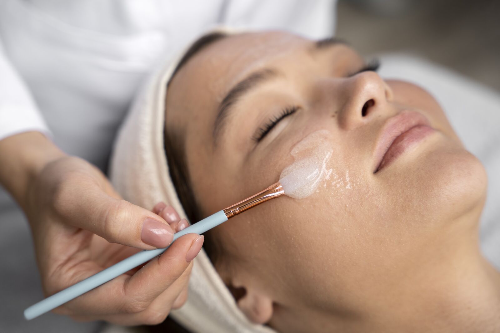 Chemical Peels / Organic Peels treatment at Derma Essence Noida