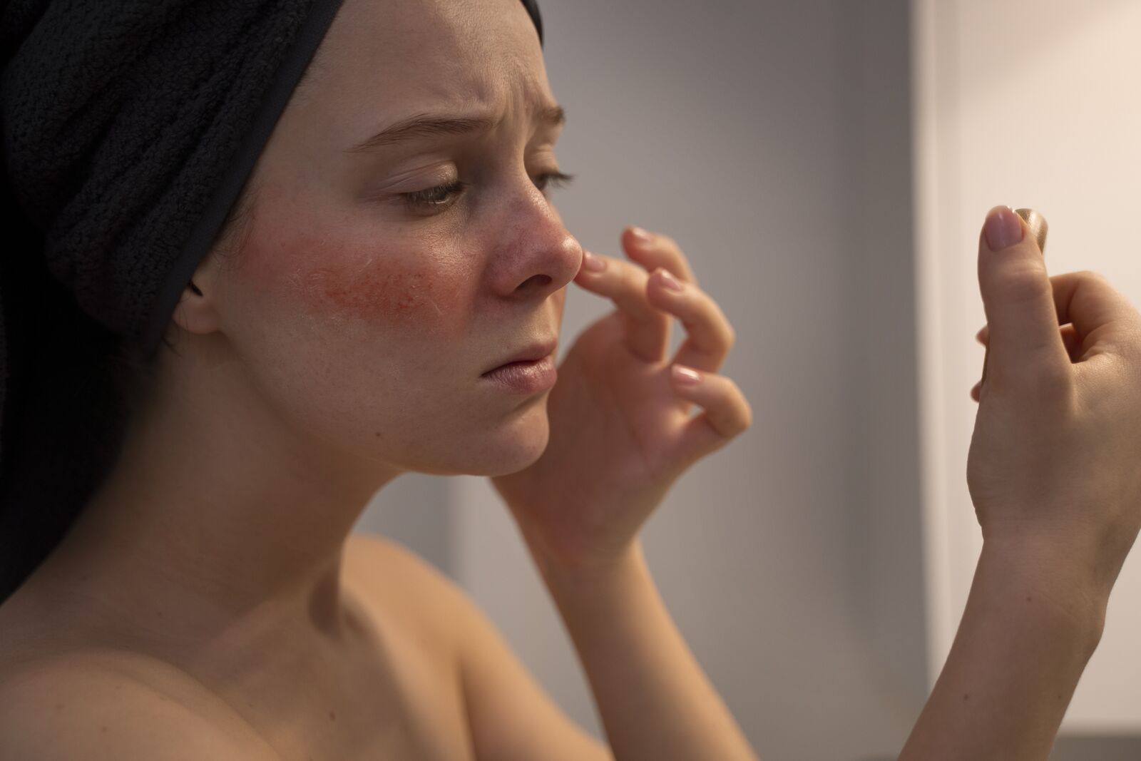 Contact Dermatitis treatment at Derma Essence Noida