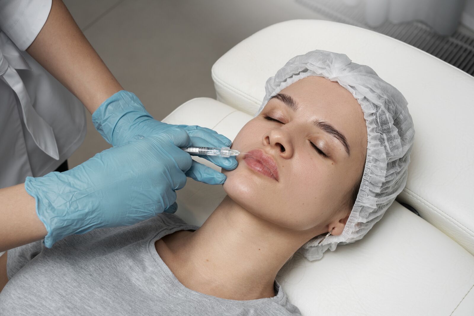 Lip Enhancement treatment at Derma Essence Noida