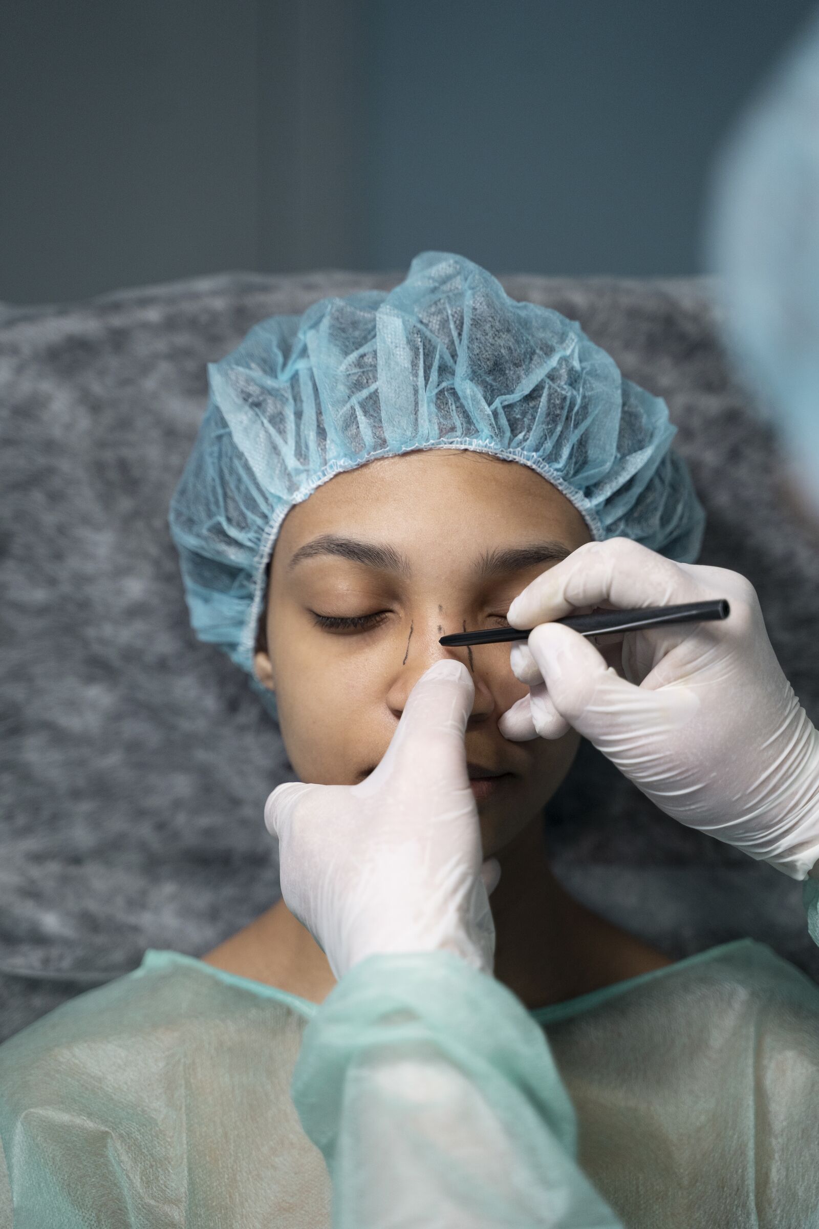 Nose Enhancement treatment at Derma Essence Noida