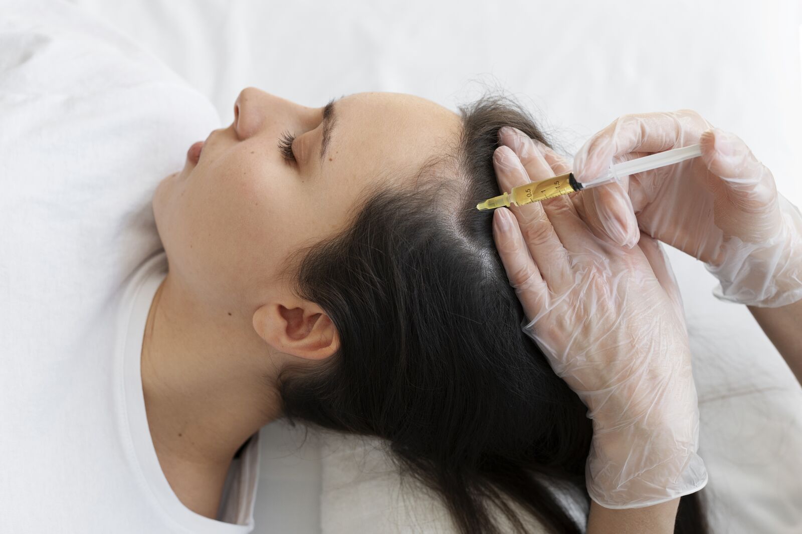 PRP Hair Treatment in Noida | Procedure | Cost | Benefits treatment at Derma Essence Noida