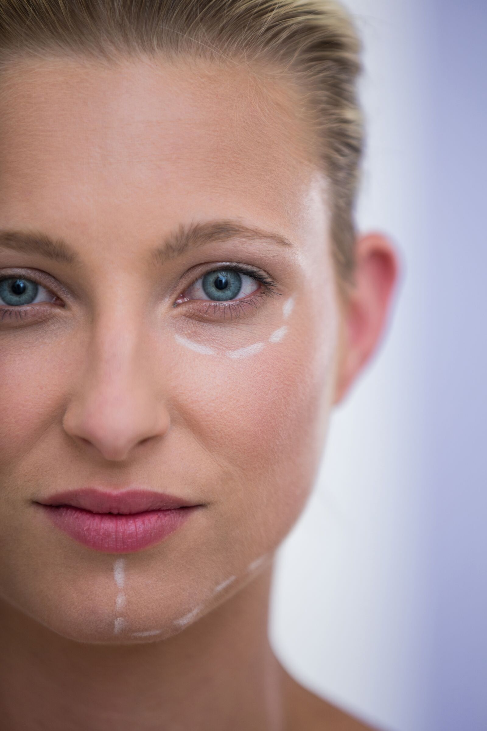 Under Eye Treatment treatment at Derma Essence Noida